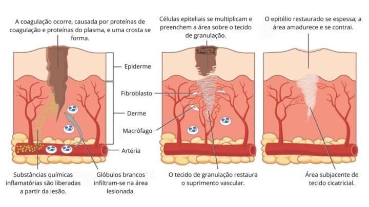 Diagrama apresentando estágios de cicatrização tecidual