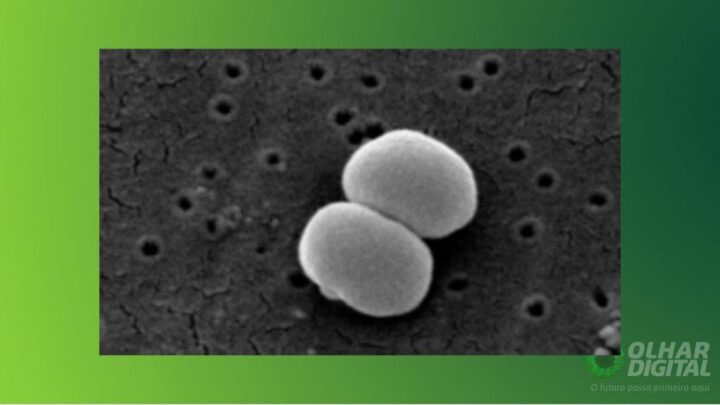 Staphylococcus epidermidis