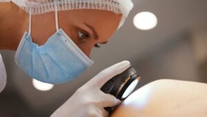 Câncer de pele: novo tratamento inicia testes em humanos no Brasil